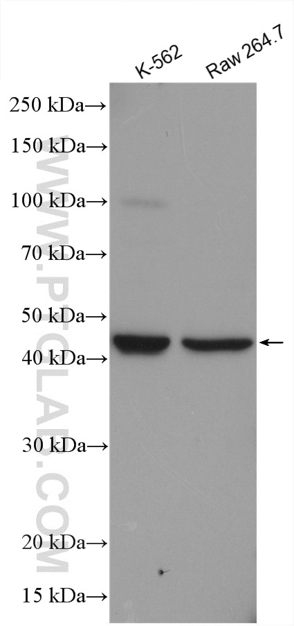 Western Blot (WB) analysis of various lysates using MAP2K4 Polyclonal antibody (17340-1-AP)