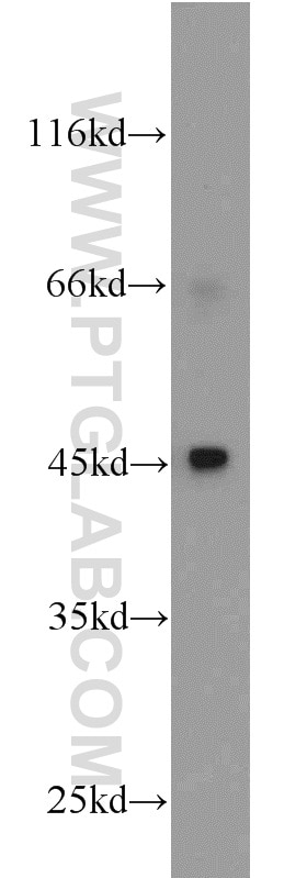 MAP2K4 Polyclonal antibody