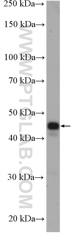 Western Blot (WB) analysis of mouse brain tissue using MAP2K4 Polyclonal antibody (51142-1-AP)