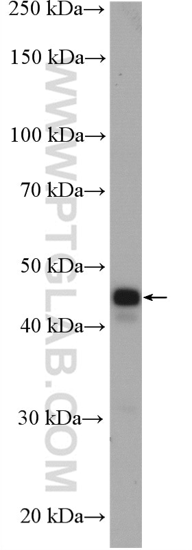 WB analysis of mouse brain using 51142-1-AP