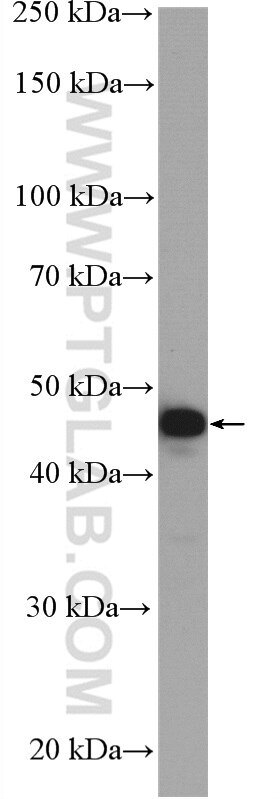Western Blot (WB) analysis of mouse brain tissue using MAP2K4 Polyclonal antibody (51142-1-AP)