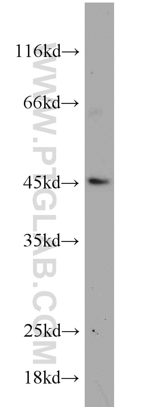 Western Blot (WB) analysis of HeLa cells using MAP2K4 Polyclonal antibody (51142-1-AP)