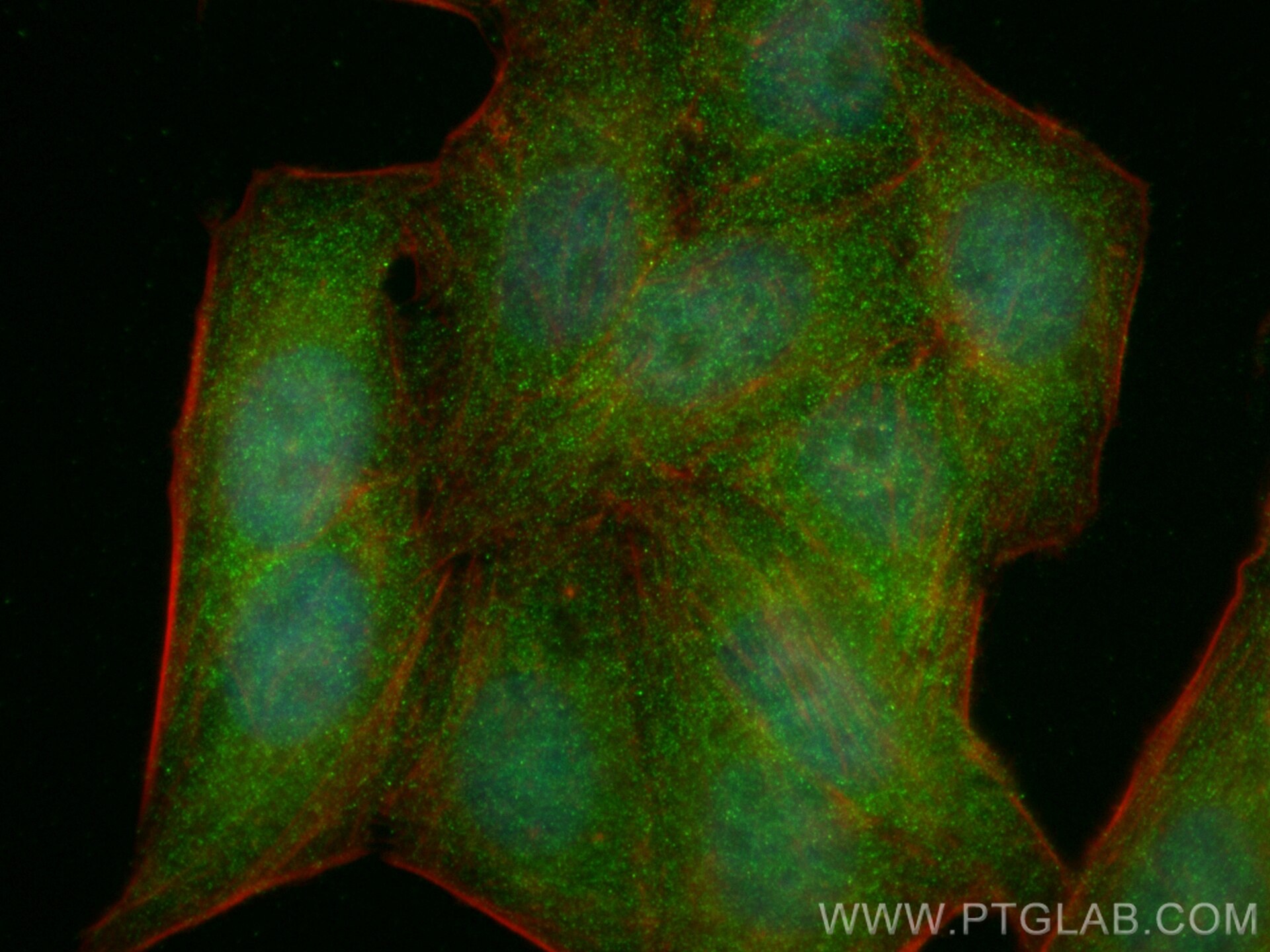 Immunofluorescence (IF) / fluorescent staining of HepG2 cells using MAP2K4 Monoclonal antibody (67333-1-Ig)