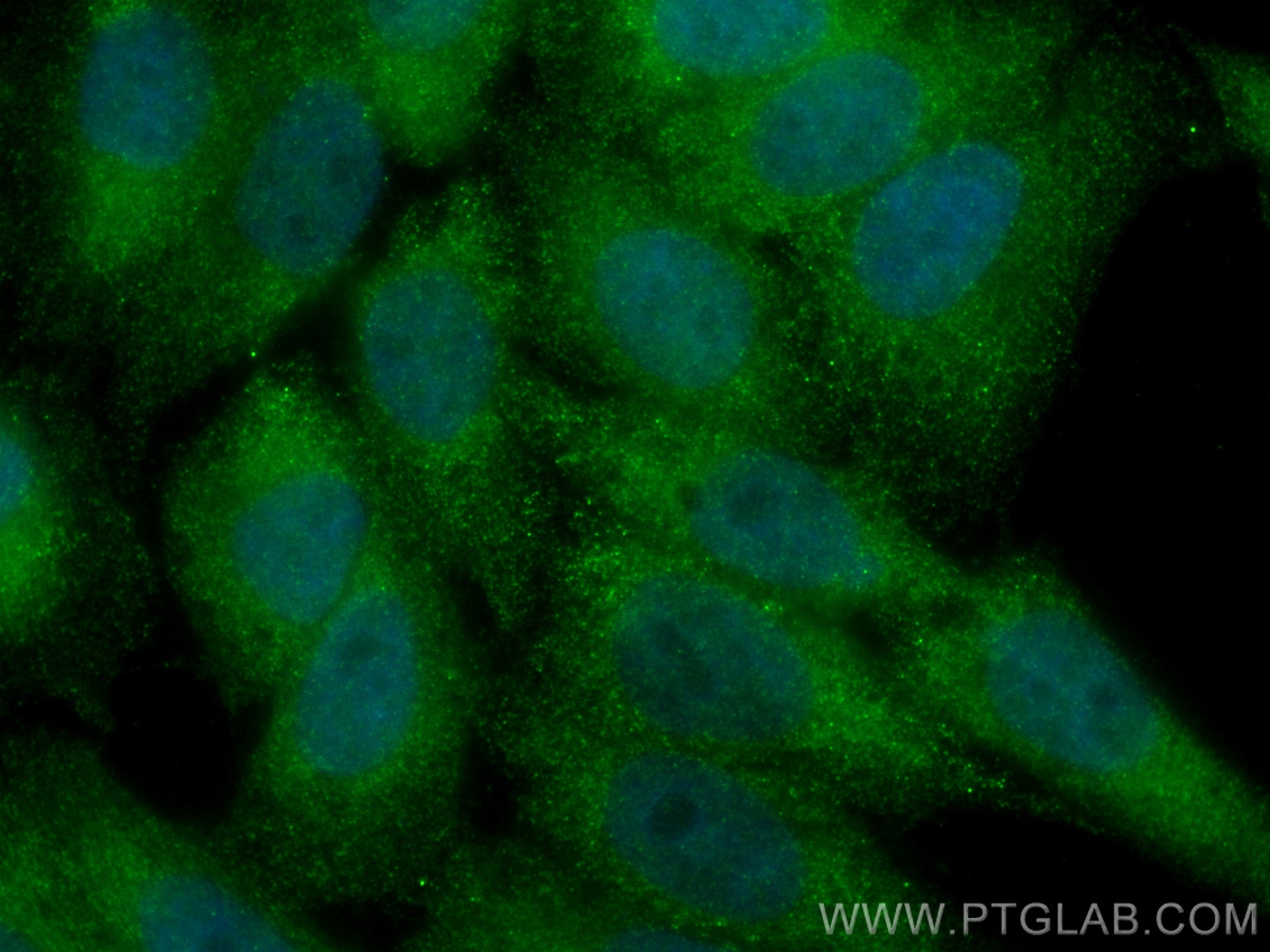 Immunofluorescence (IF) / fluorescent staining of HepG2 cells using CoraLite® Plus 488-conjugated MAP2K4 Monoclonal an (CL488-67333)