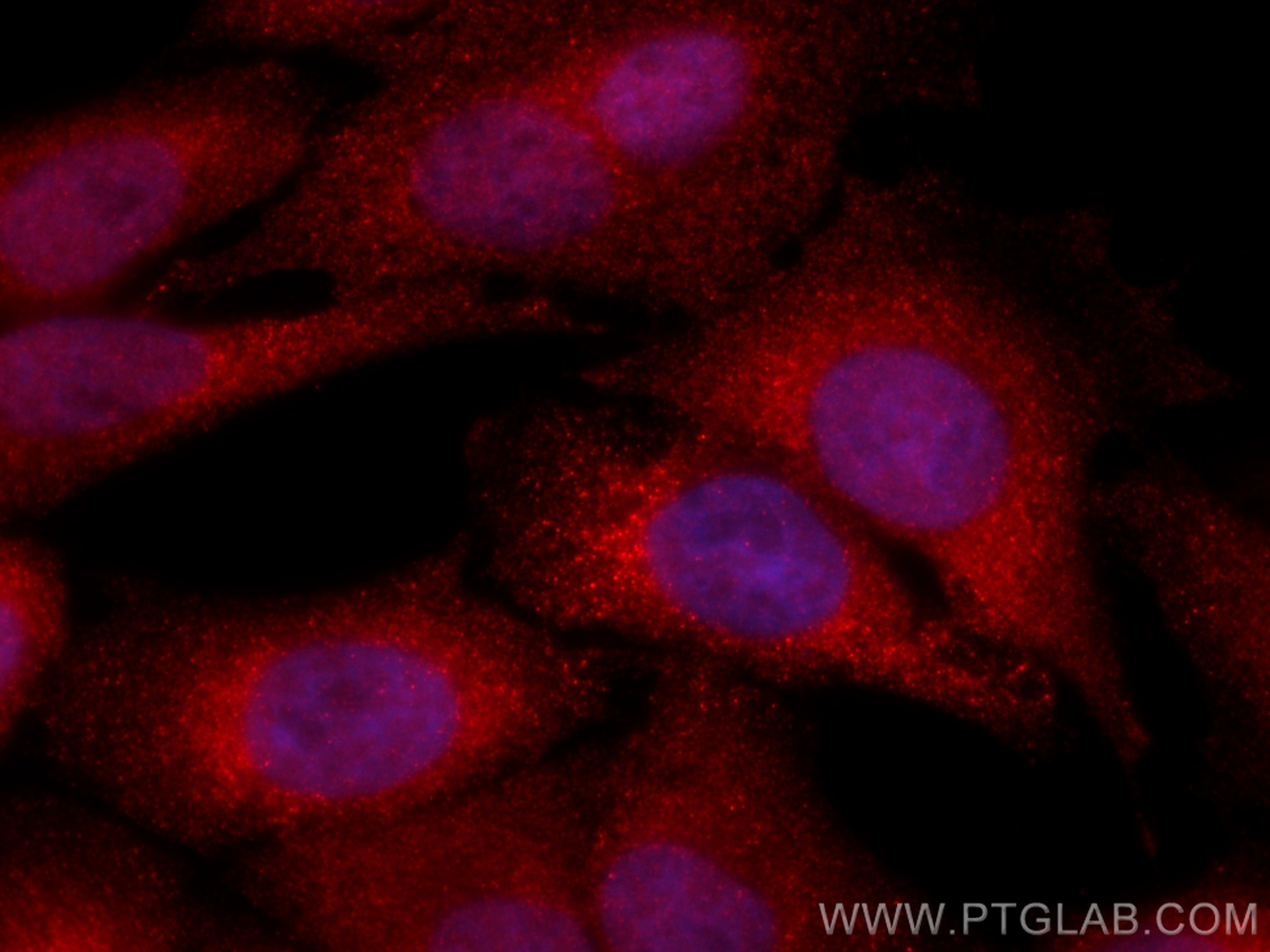 Immunofluorescence (IF) / fluorescent staining of HepG2 cells using CoraLite®594-conjugated MAP2K4 Monoclonal antibody (CL594-67333)