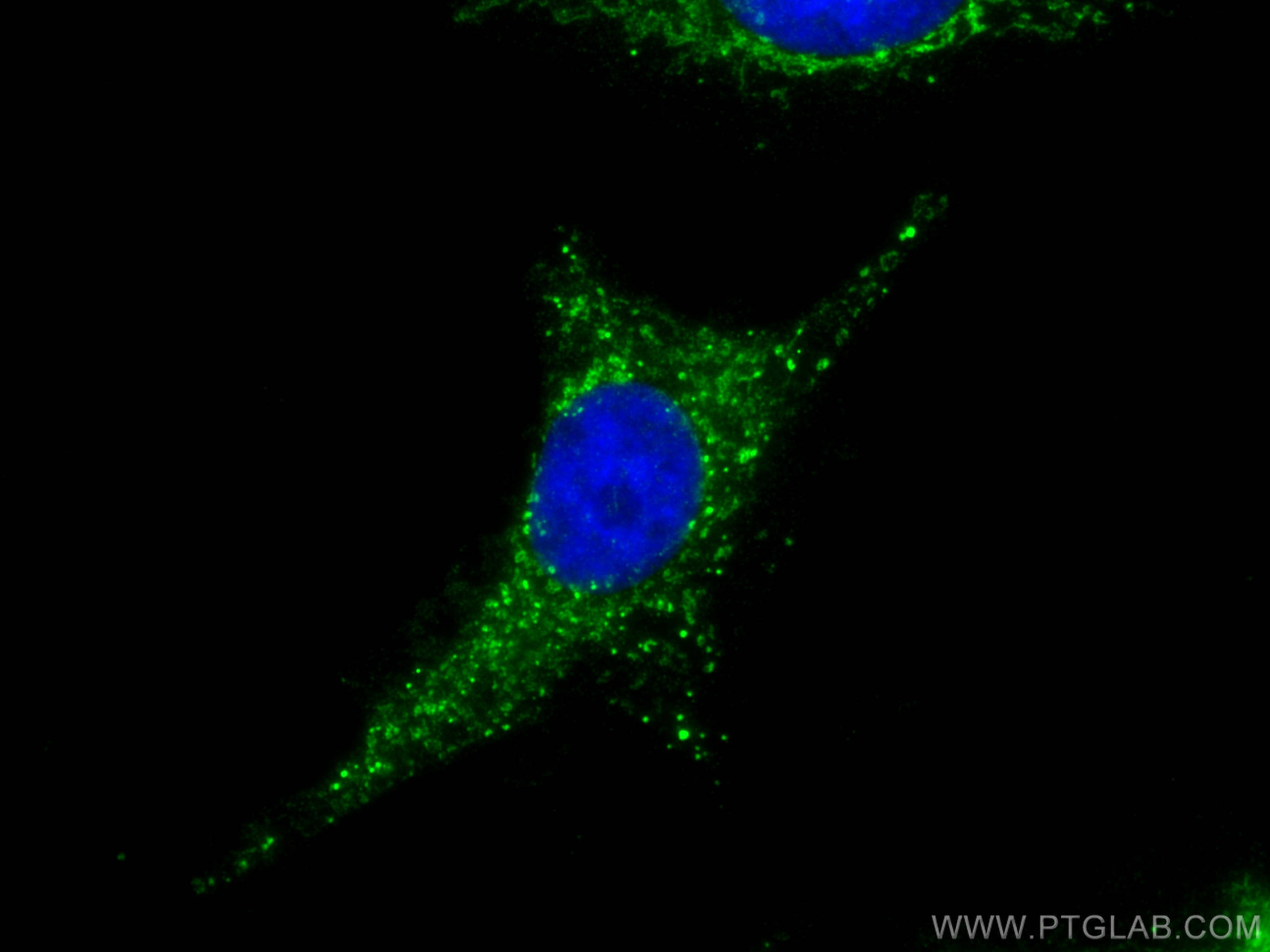 Immunofluorescence (IF) / fluorescent staining of HeLa cells using MEK5 Polyclonal antibody (15758-1-AP)