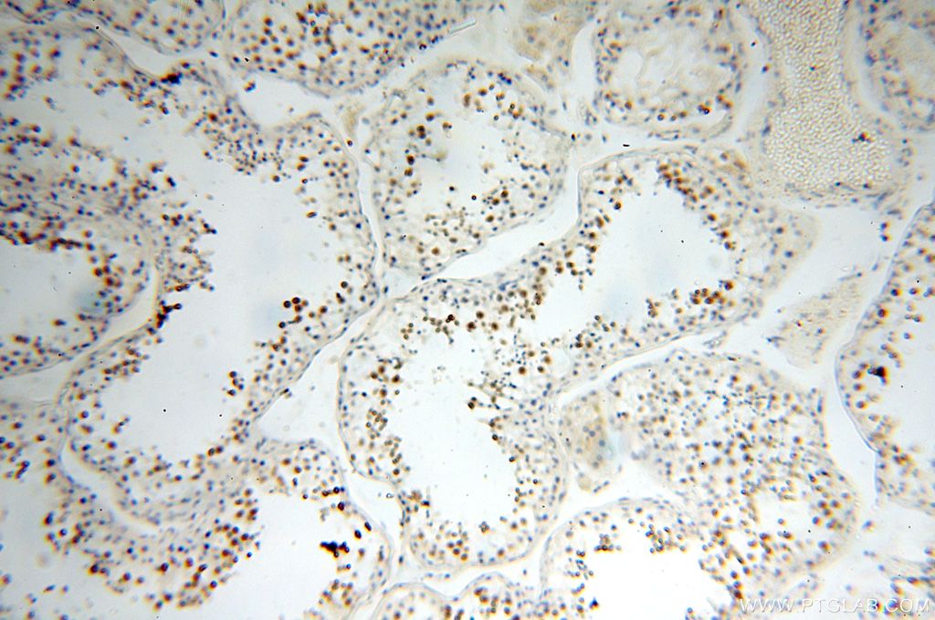IHC staining of human testis using 15758-1-AP