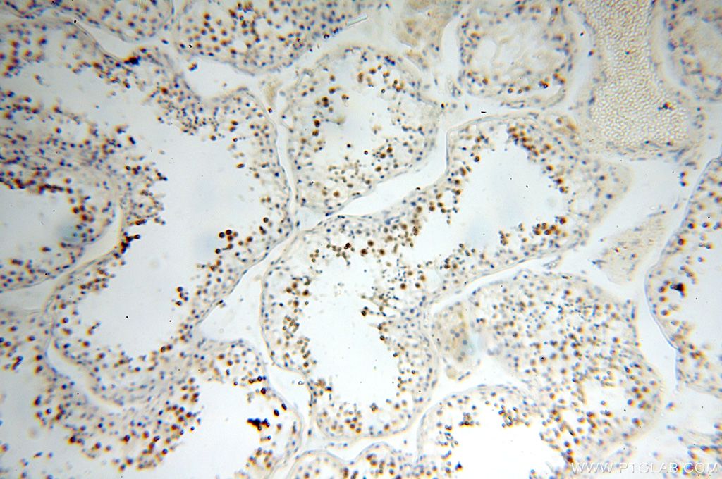 Immunohistochemistry (IHC) staining of human testis tissue using MEK5 Polyclonal antibody (15758-1-AP)