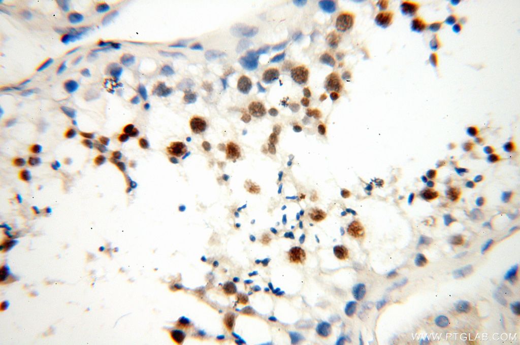 Immunohistochemistry (IHC) staining of human testis tissue using MEK5 Polyclonal antibody (15758-1-AP)