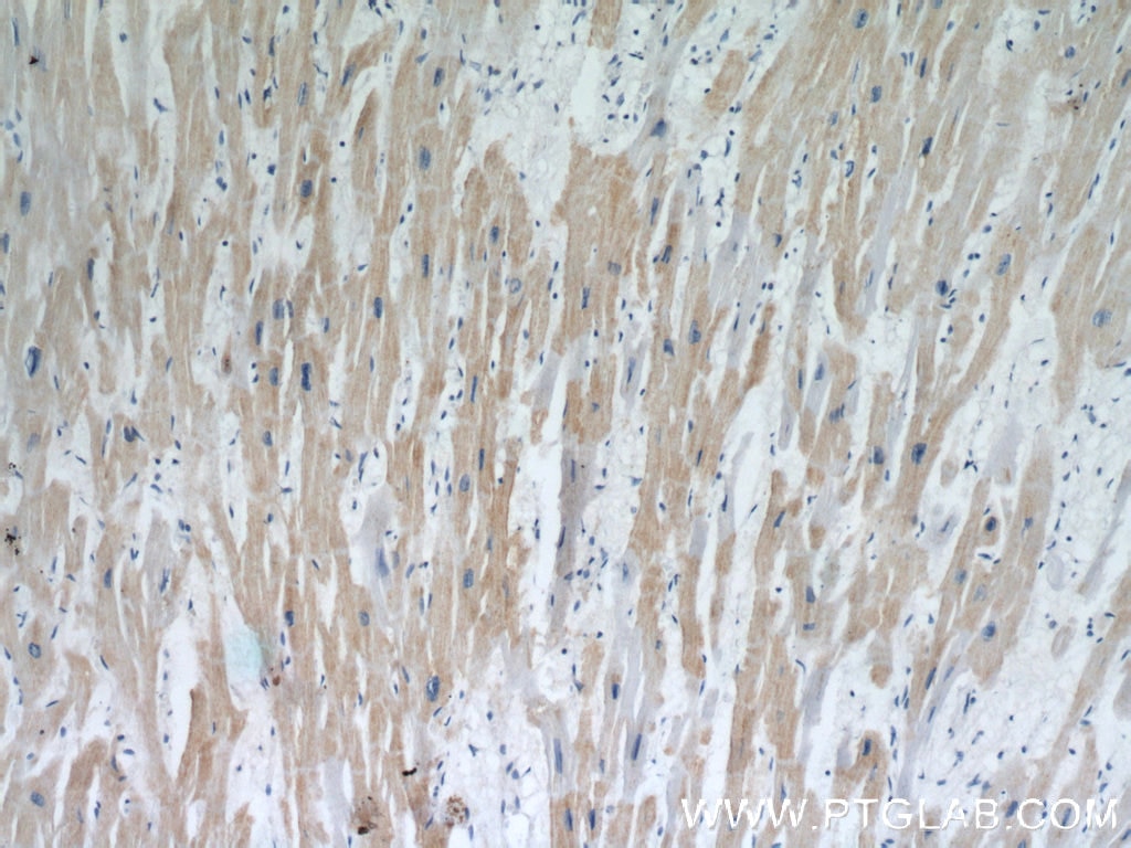 Immunohistochemistry (IHC) staining of human heart tissue using MEK5 Polyclonal antibody (15758-1-AP)