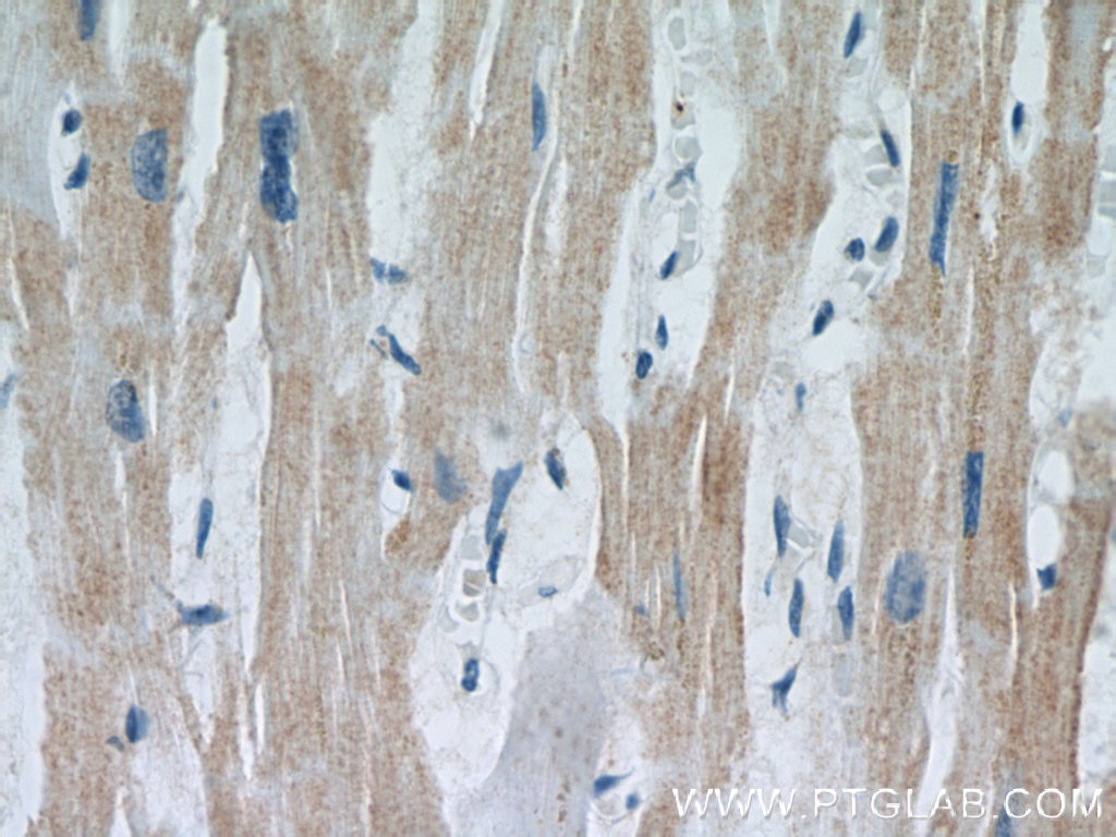 Immunohistochemistry (IHC) staining of human heart tissue using MEK5 Polyclonal antibody (15758-1-AP)
