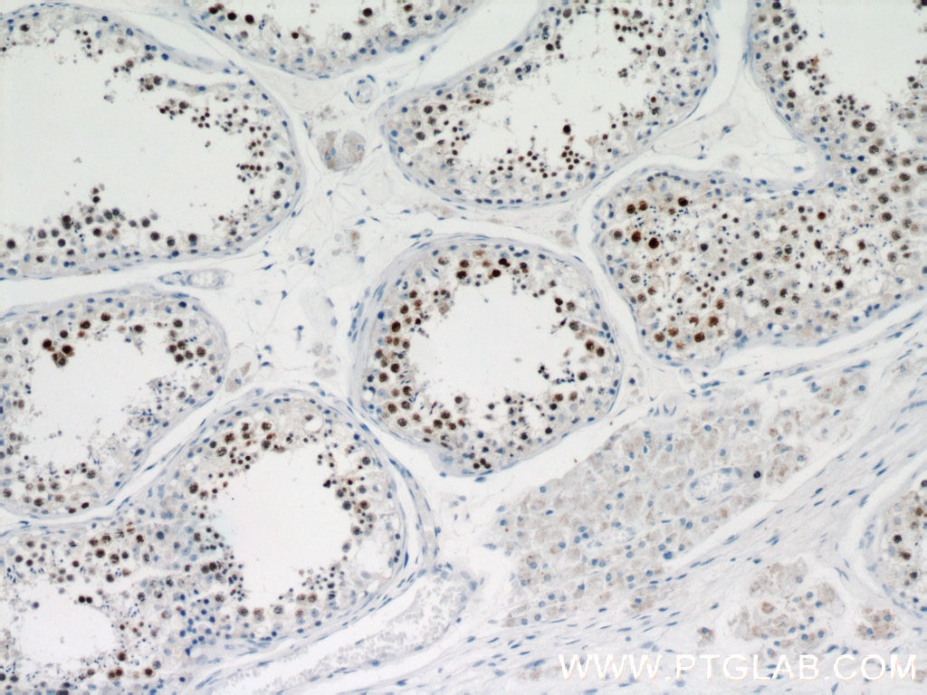 Immunohistochemistry (IHC) staining of human testis tissue using MEK5 Polyclonal antibody (15758-1-AP)