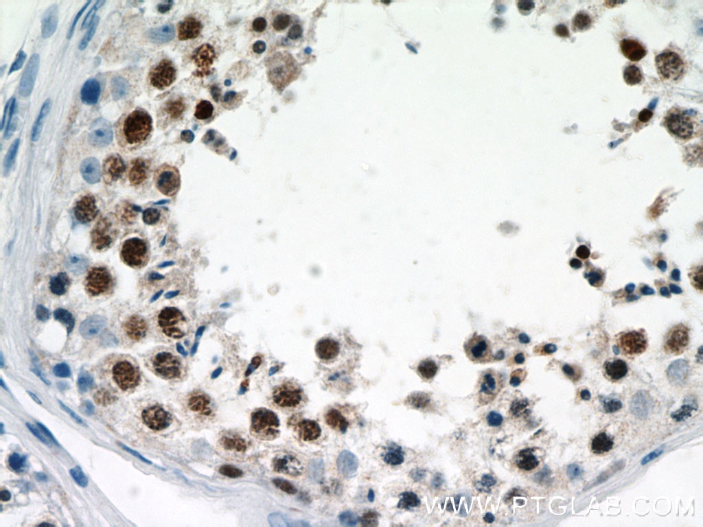 Immunohistochemistry (IHC) staining of human testis tissue using MEK5 Polyclonal antibody (15758-1-AP)