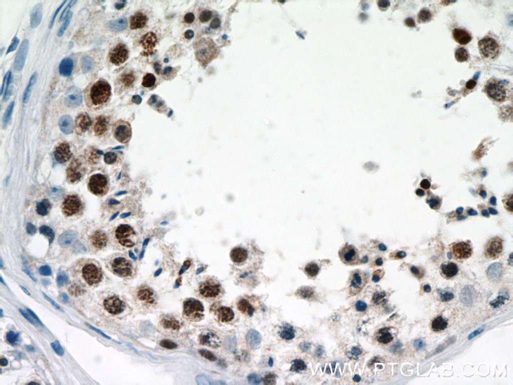 IHC staining of human testis using 15758-1-AP