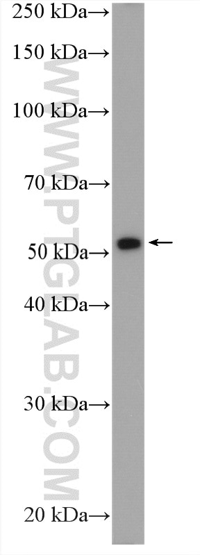 Western Blot (WB) analysis of HeLa cells using MEK5 Polyclonal antibody (15758-1-AP)