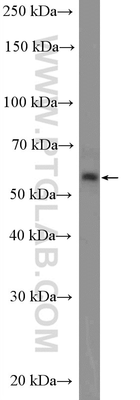 Western Blot (WB) analysis of A431 cells using MEK5 Polyclonal antibody (15758-1-AP)