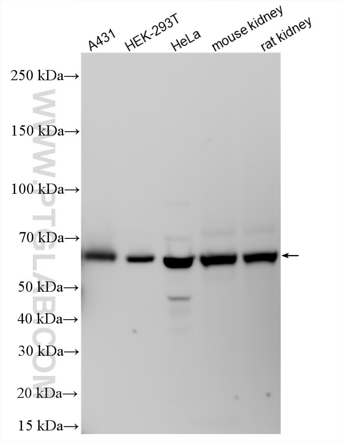 Western Blot (WB) analysis of various lysates using MEK5 Polyclonal antibody (15758-1-AP)