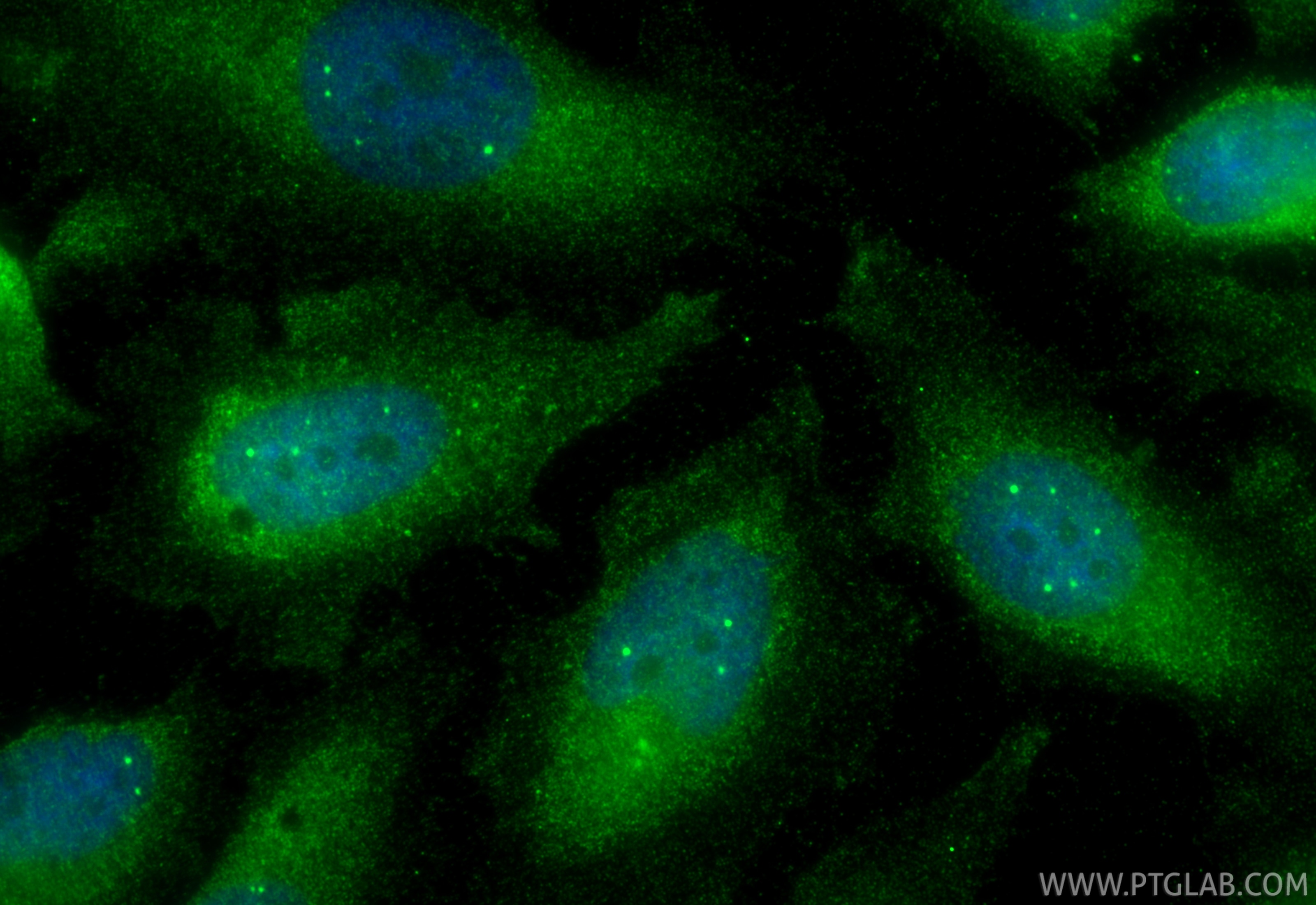 Immunofluorescence (IF) / fluorescent staining of HeLa cells using MEK6 Polyclonal antibody (12745-1-AP)