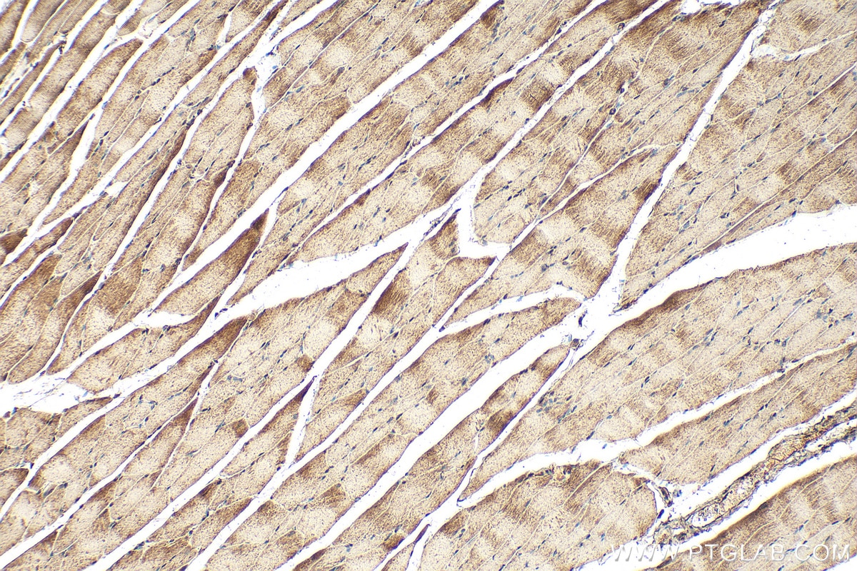 Immunohistochemistry (IHC) staining of rat skeletal muscle tissue using MEK6 Polyclonal antibody (12745-1-AP)