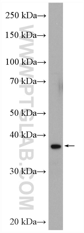 Western Blot (WB) analysis of HeLa cells using MEK6 Polyclonal antibody (12745-1-AP)