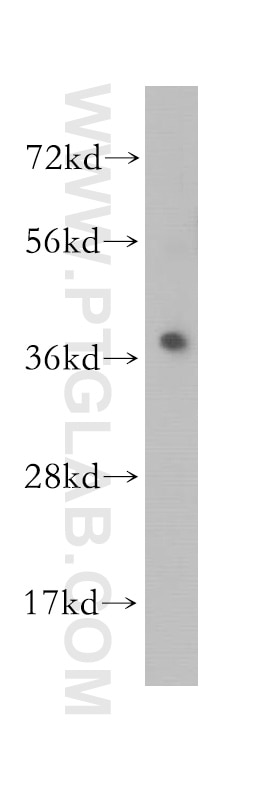 Western Blot (WB) analysis of human kidney tissue using MEK6 Polyclonal antibody (12745-1-AP)