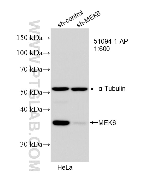 WB result of MEK6 antibody (51094-1-AP; 1:600; incubated at room temperature for 1.5 hours) with sh-Control and sh-MEK6 transfected HeLa cells. Western Blot (WB) analysis of HeLa cells using MEK6 Polyclonal antibody (51094-1-AP)