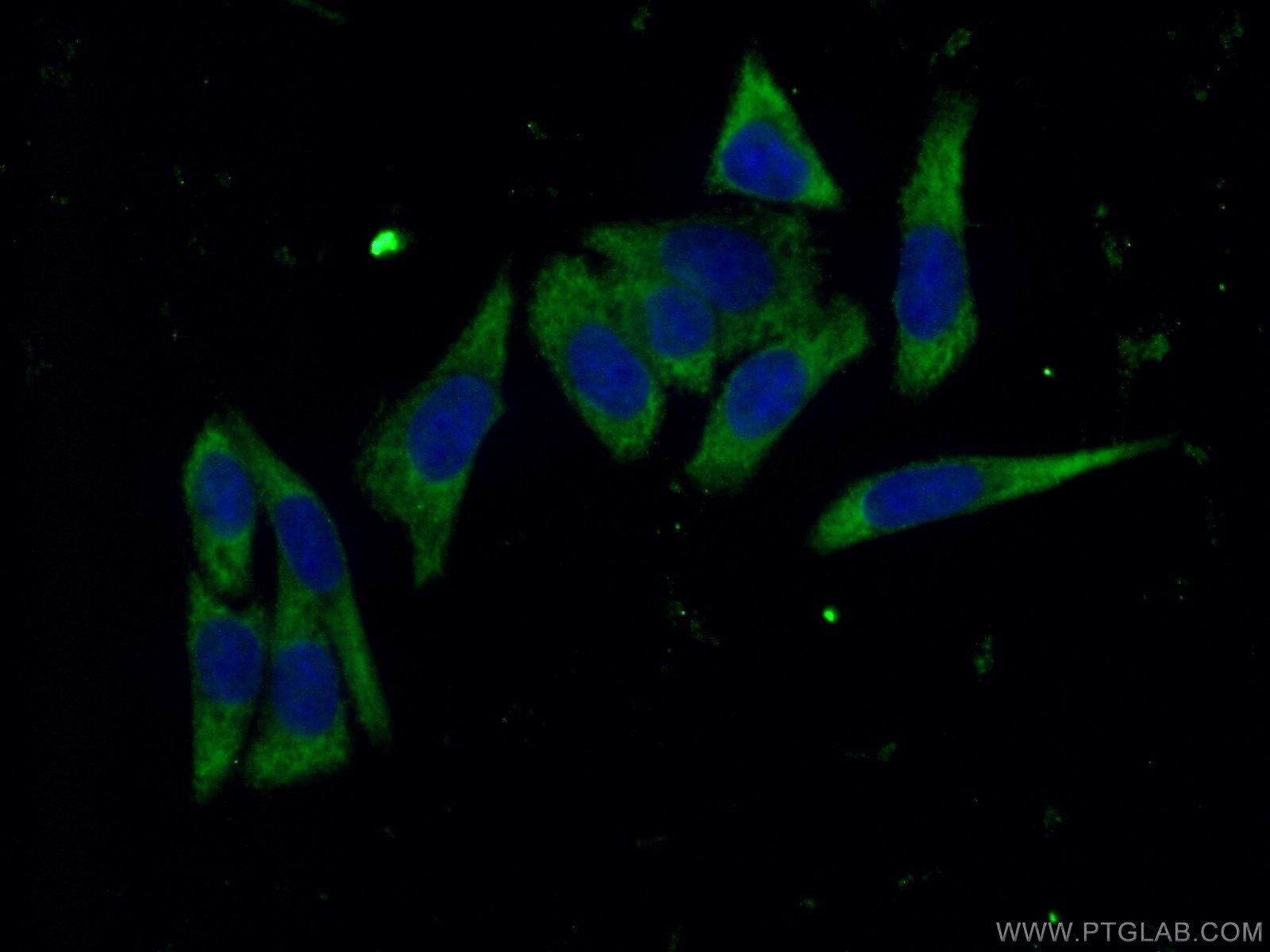 Immunofluorescence (IF) / fluorescent staining of HeLa cells using MAP3K1 Polyclonal antibody (19970-1-AP)