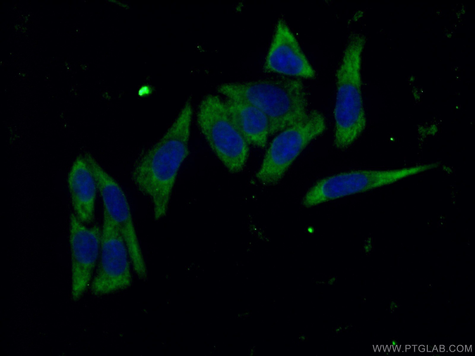 IF Staining of HeLa using 19970-1-AP