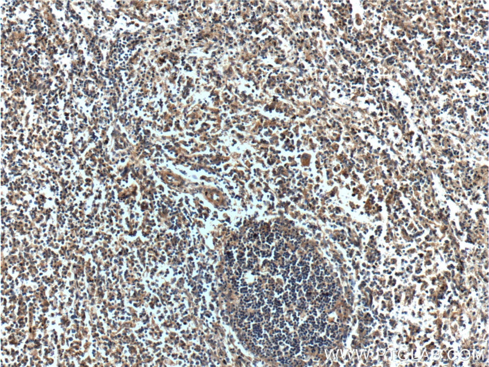Immunohistochemistry (IHC) staining of human spleen tissue using MAP3K1 Polyclonal antibody (19970-1-AP)
