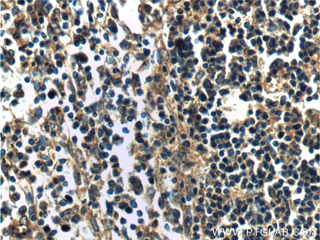 Immunohistochemistry (IHC) staining of human spleen tissue using MAP3K1 Polyclonal antibody (19970-1-AP)