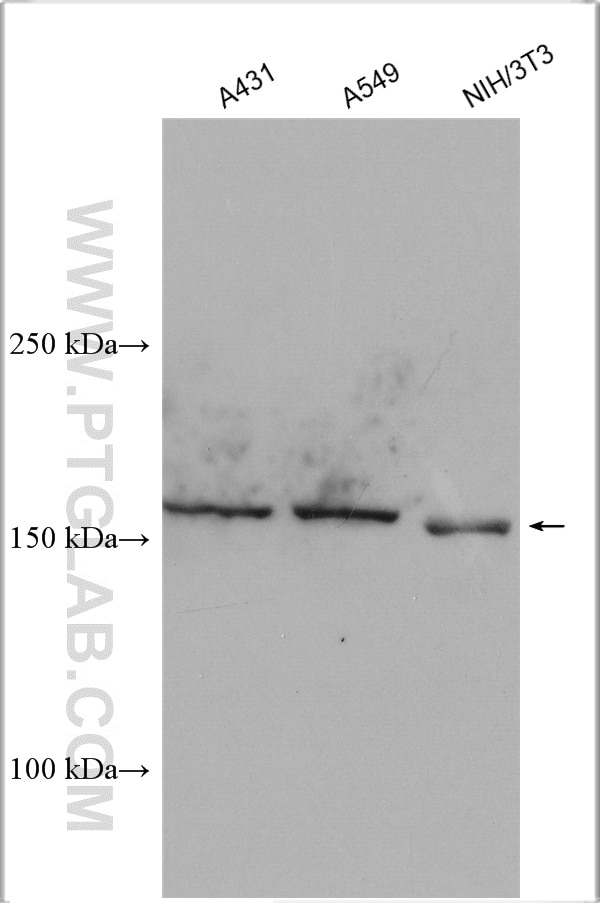 Western Blot (WB) analysis of various lysates using MAP3K1 Polyclonal antibody (19970-1-AP)