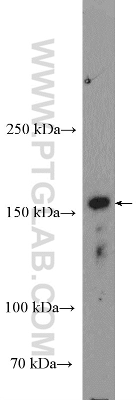 Western Blot (WB) analysis of mouse spleen tissue using MAP3K1 Polyclonal antibody (19970-1-AP)