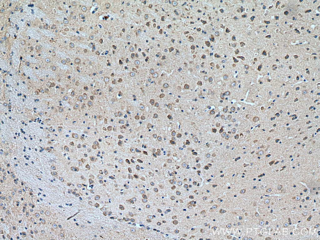 Immunohistochemistry (IHC) staining of mouse brain tissue using MLK2 Polyclonal antibody (19974-1-AP)