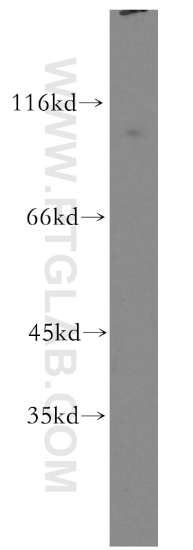 Western Blot (WB) analysis of human brain tissue using MLK2 Polyclonal antibody (19974-1-AP)