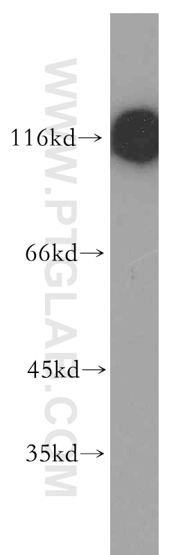 Western Blot (WB) analysis of human skeletal muscle tissue using MLK2 Polyclonal antibody (19974-1-AP)