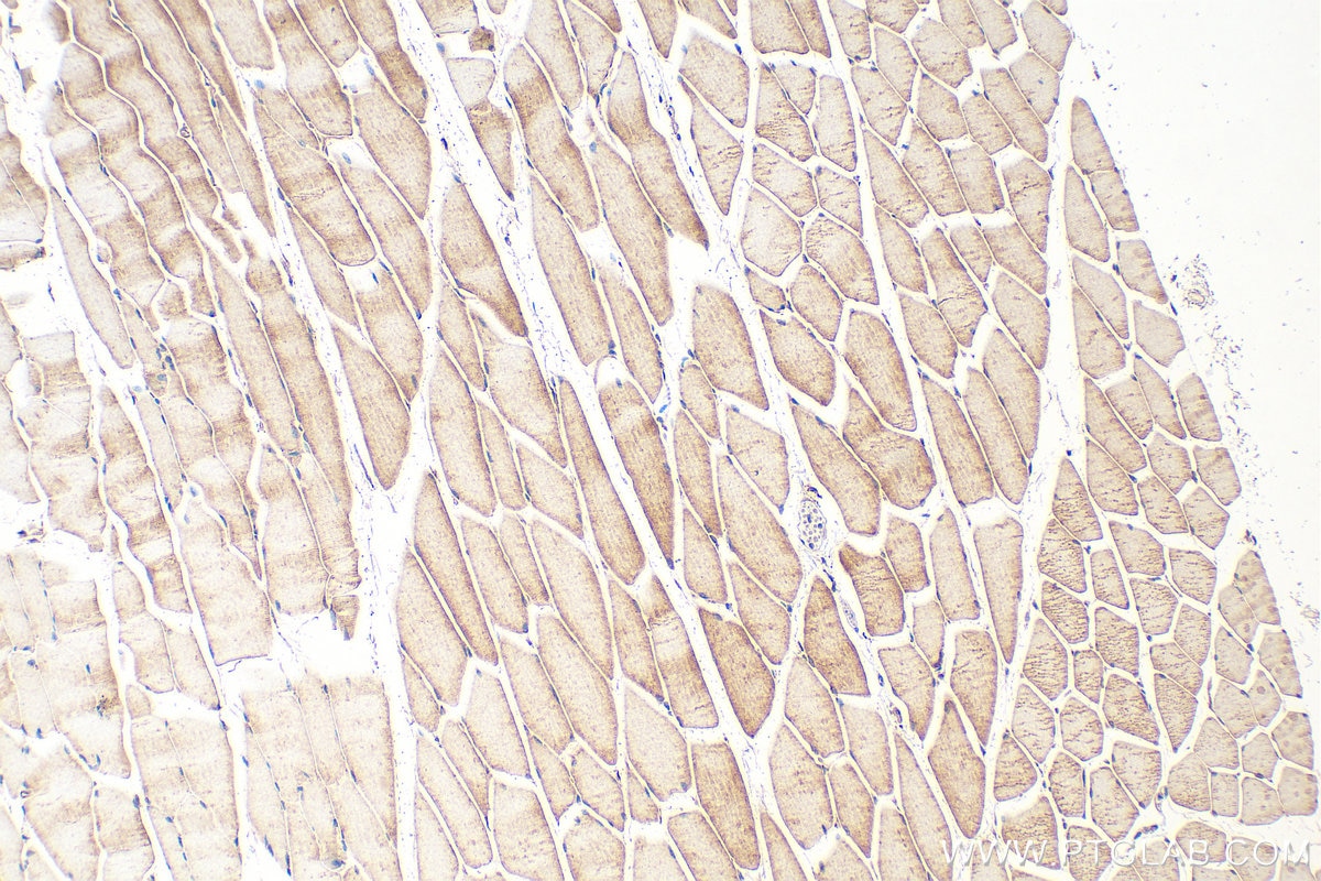 Immunohistochemistry (IHC) staining of mouse skeletal muscle tissue using MLK2 Polyclonal antibody (29985-1-AP)