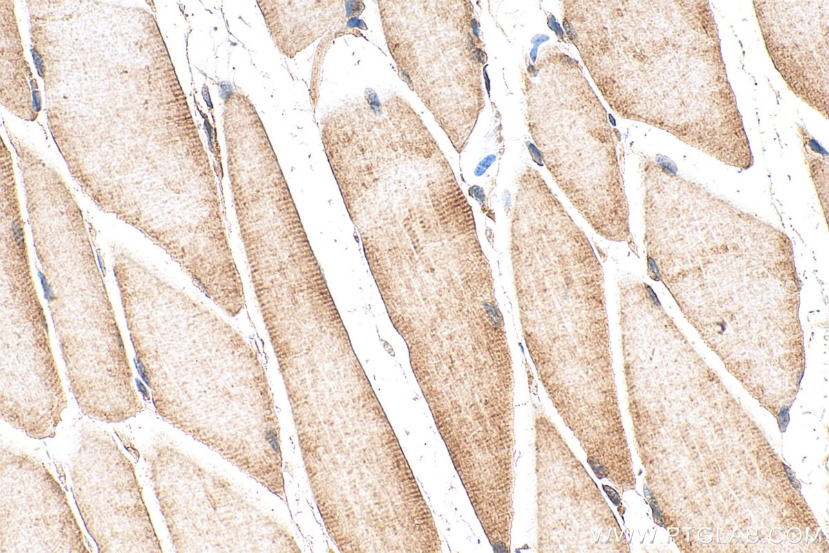 Immunohistochemistry (IHC) staining of mouse skeletal muscle tissue using MLK2 Polyclonal antibody (29985-1-AP)