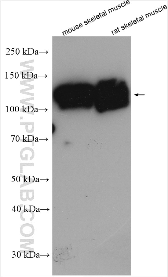 Western Blot (WB) analysis of various lysates using MAP3K10 Polyclonal antibody (29985-1-AP)