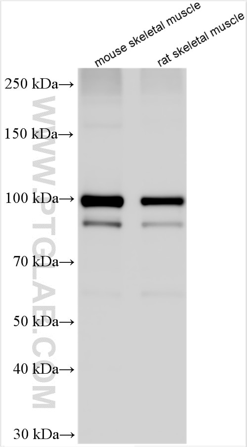 Western Blot (WB) analysis of various lysates using MAP3K10 Polyclonal antibody (29985-1-AP)