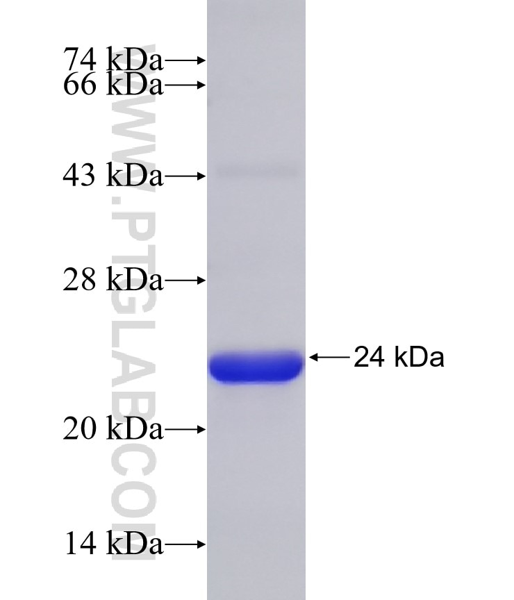 MAP3K10 fusion protein Ag31582 SDS-PAGE MAP3K10 fusion protein Ag31582 SDS-PAGE