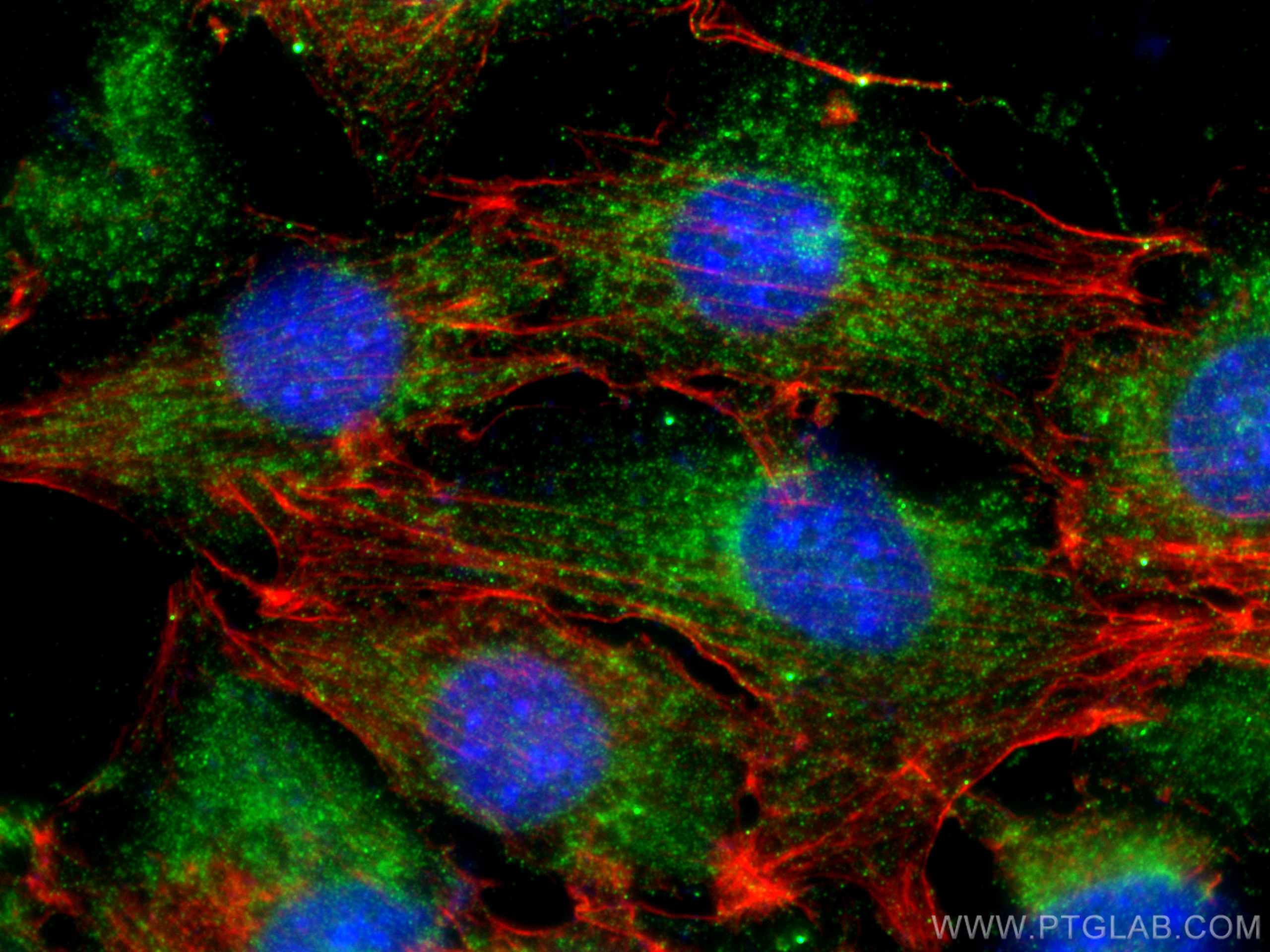 Immunofluorescence (IF) / fluorescent staining of NIH/3T3 cells using MLK3 Polyclonal antibody (11996-1-AP)