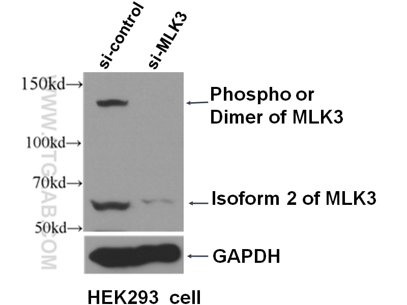 Western Blot (WB) analysis of HEK-293 cells using MLK3 Polyclonal antibody (11996-1-AP)