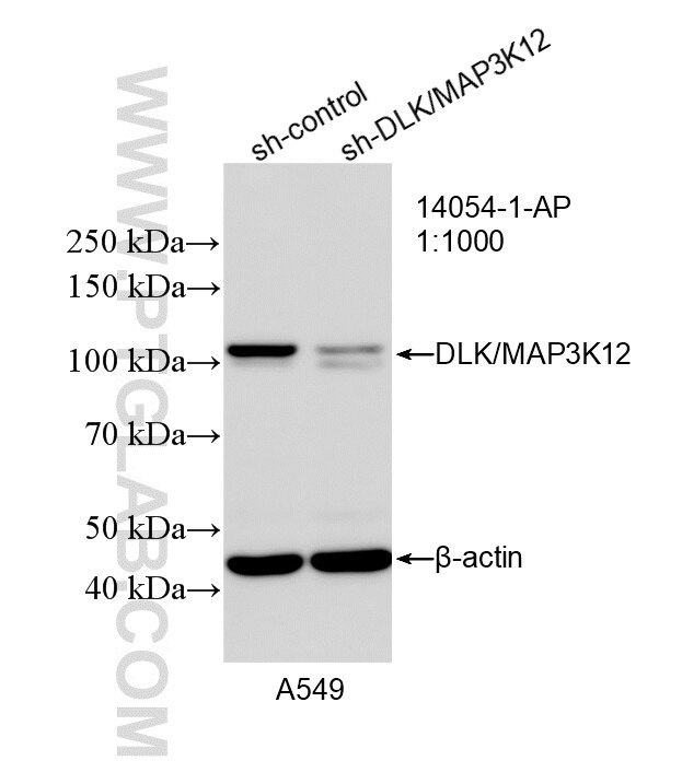 WB result of DLK/MAP3K12 antibody (14054-1-AP; 1:1000; incubated at room temperature for 1.5 hours) with sh-Control and sh-DLK/MAP3K12 transfected A549 cells. Western Blot (WB) analysis of A549 cells using DLK/MAP3K12 Polyclonal antibody (14054-1-AP)