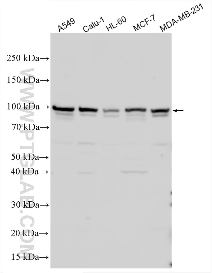 Various lysates were subjected to SDS PAGE followed by western blot with 14054-1-AP (DLK/MAP3K12 antibody) at dilution of 1:2500 incubated at room temperature for 1.5 hours. Western Blot (WB) analysis of various lysates using DLK/MAP3K12 Polyclonal antibody (14054-1-AP)
