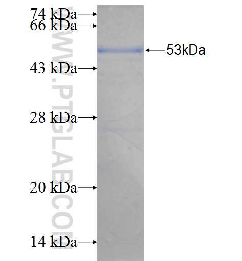 MAP3K14 fusion protein Ag26406 SDS-PAGE