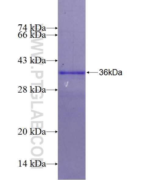 MAP3K14 fusion protein Ag26418 SDS-PAGE