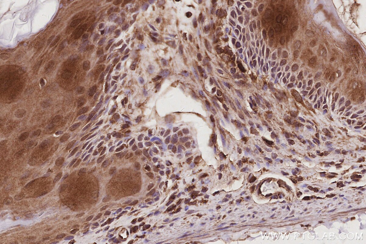 IHC staining of mouse stomach using 29265-1-AP Immunohistochemistry (IHC) staining of mouse stomach tissue using MEKK2 Polyclonal antibody (29265-1-AP)
