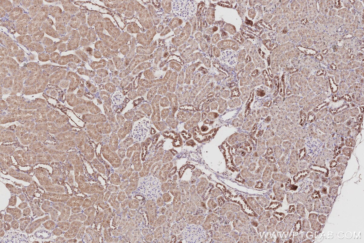 IHC staining of rat kidney using 29265-1-AP Immunohistochemistry (IHC) staining of rat kidney tissue using MEKK2 Polyclonal antibody (29265-1-AP)