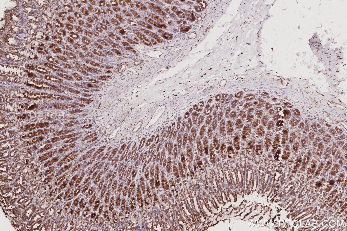 IHC staining of rat stomach using 29265-1-AP Immunohistochemistry (IHC) staining of rat stomach tissue using MEKK2 Polyclonal antibody (29265-1-AP)