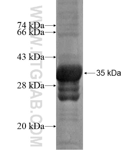 MAP3K3 fusion protein Ag15223 SDS-PAGE